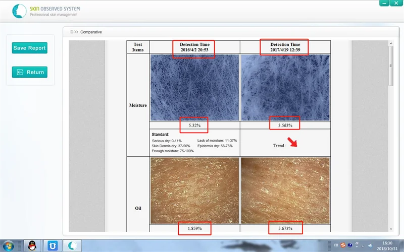 Portable High Definition Pixel Aesthetic Skin Analyzer
