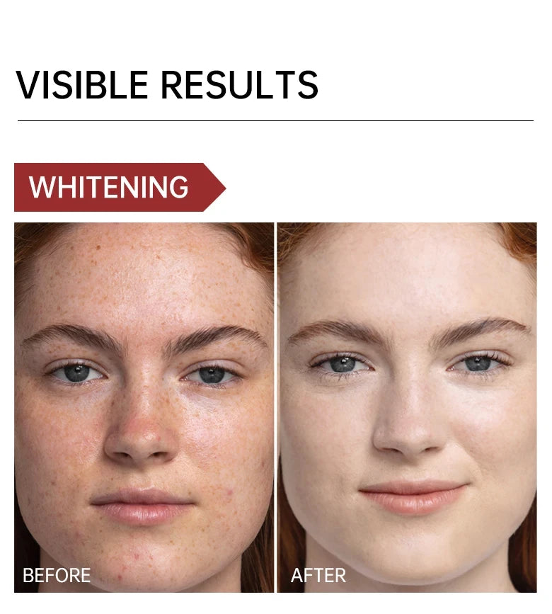 Niacinamide Whitening Face Serum Dark Spot Removal Moisturizing Shrinking Pore Hyaluronic Acid Nourishing Facial Skin Care