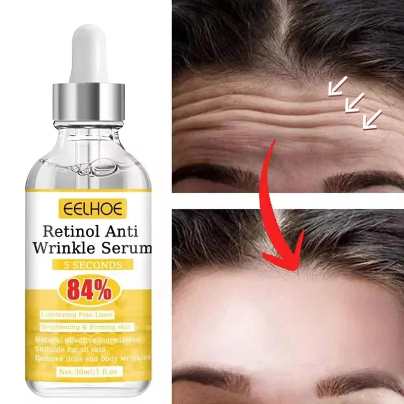 Retinol Anti-Wrinkle Serum