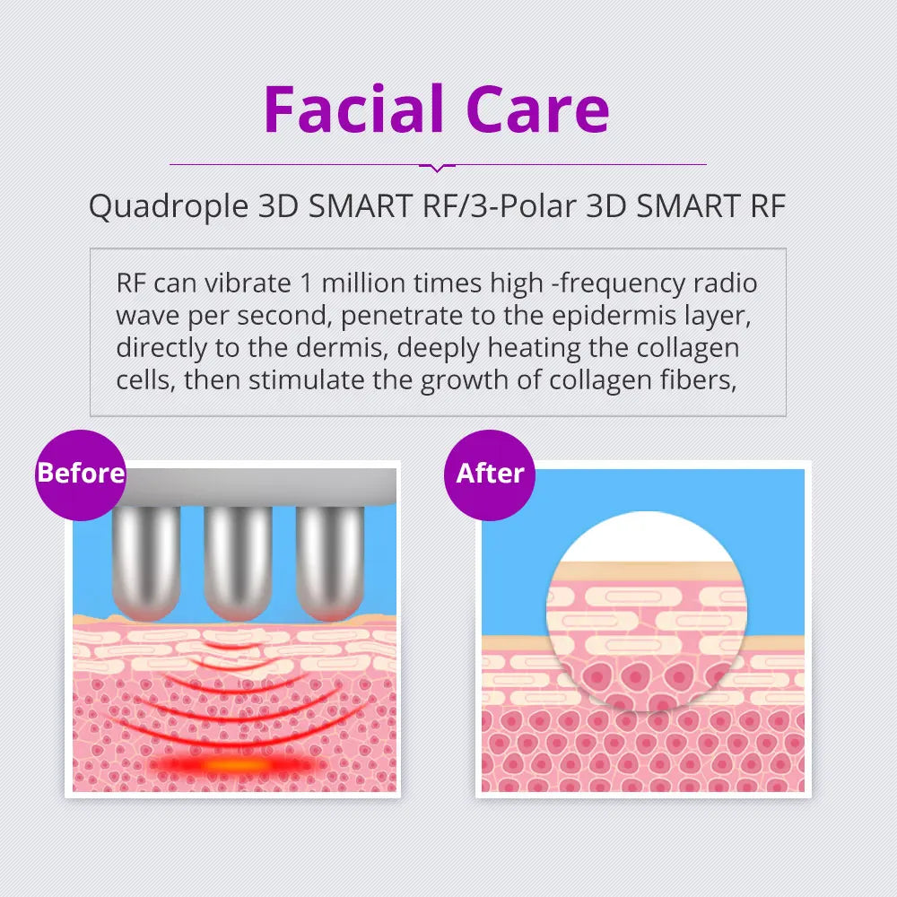 Cavitation Machine for Body Slimming/Skin Tightening
