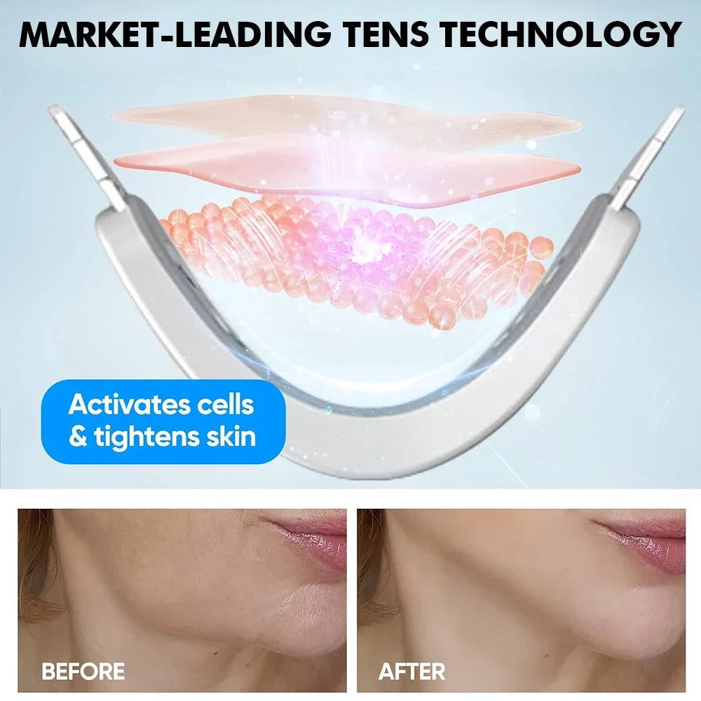 V Face Massager Portable Facial Massage Device Facial Lifting Slimming Massage Double Chin V Face Shaped Cheek Lift Belt Machine