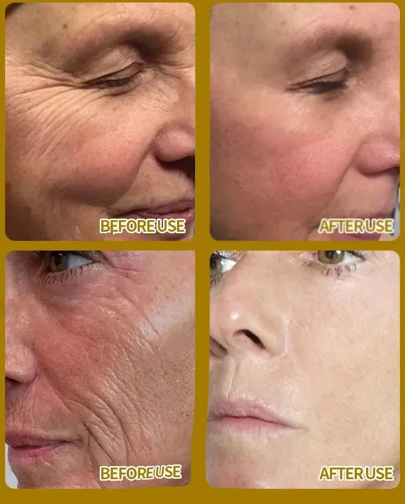 Retinol Anti-Wrinkle Serum