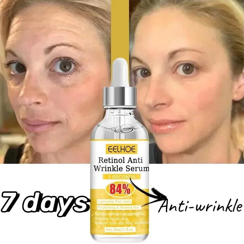 Retinol Anti-Wrinkle Serum