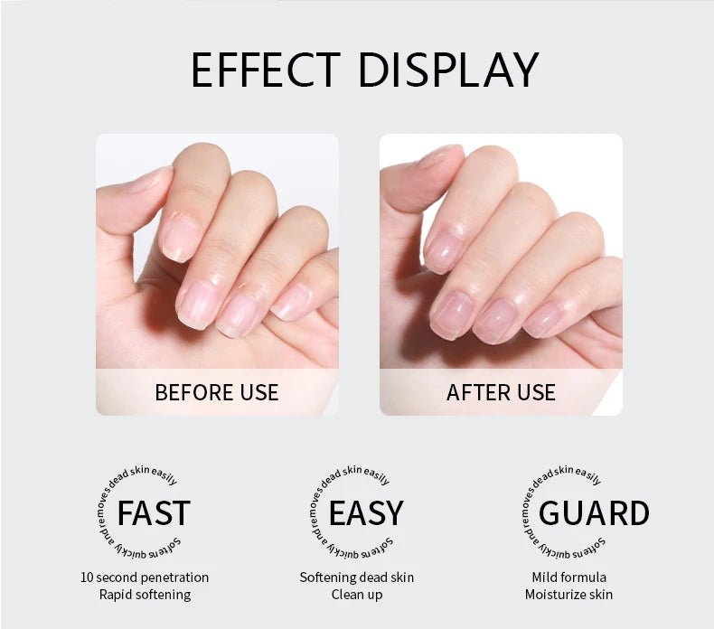 AS Cuticle Remover Liquid Cuticle Softener Professional Nail Care with Lanolin for Brittle Hang Nails Hydrating Moisturizing
