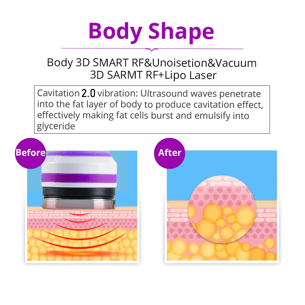 Cavitation Machine for Body Slimming/Skin Tightening