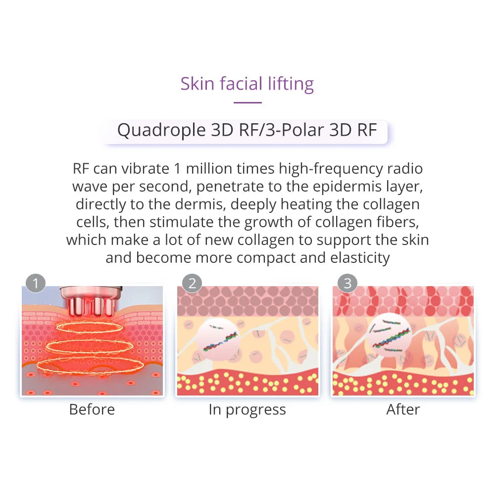 Cavitation Machine for Body Slimming/Skin Tightening