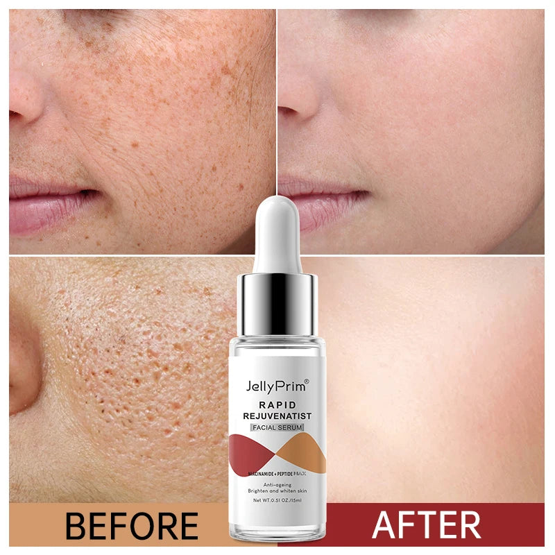 Niacinamide Whitening Face Serum Dark Spot Removal Moisturizing Shrinking Pore Hyaluronic Acid Nourishing Facial Skin Care