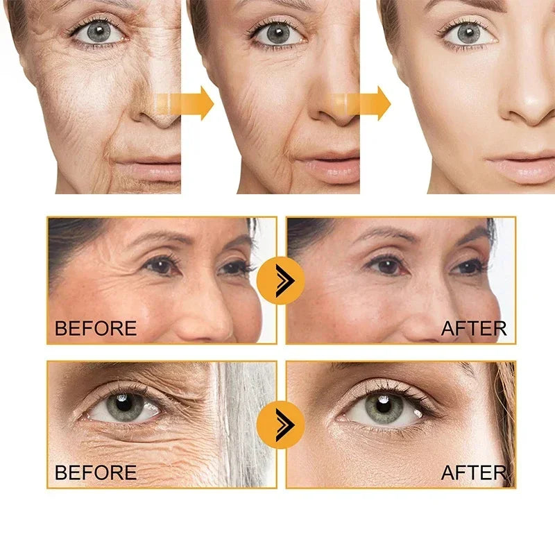 Retinol Anti-Wrinkle Serum