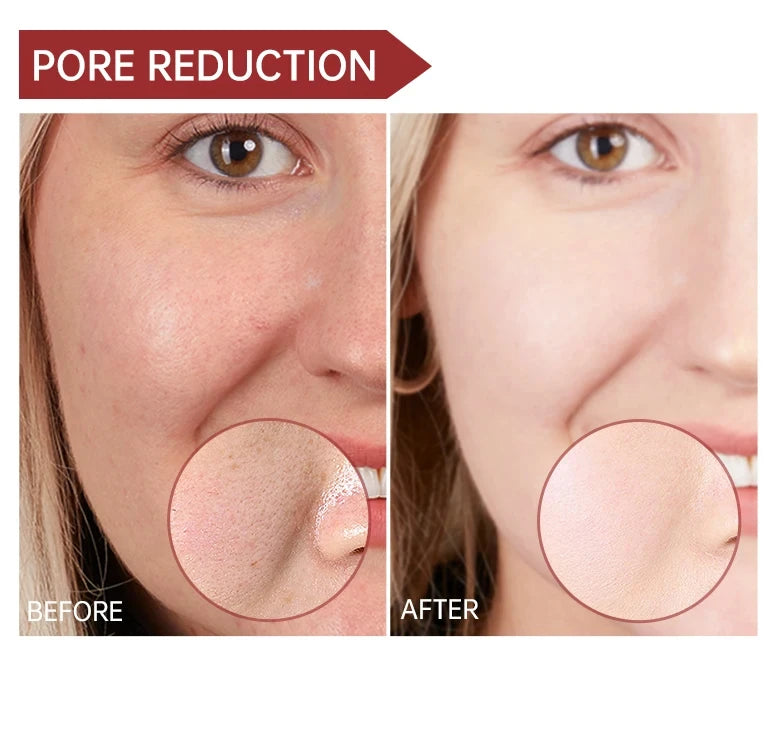 Niacinamide Whitening Face Serum Dark Spot Removal Moisturizing Shrinking Pore Hyaluronic Acid Nourishing Facial Skin Care