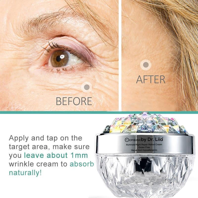 Anti-Aging Retinol Night Moisturizer – Hydrating, Vegan, Gluten-Free &amp;