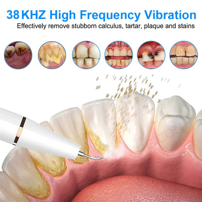 Ultrasonic Dental Teeth Plaque Remover &amp; Cleaner