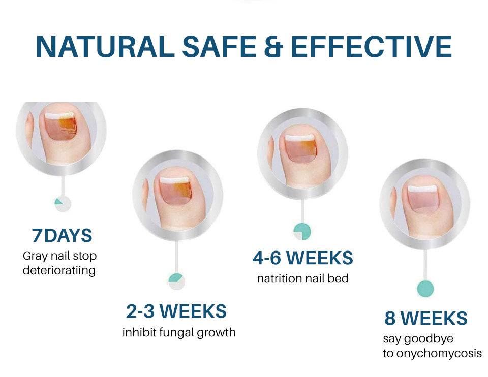 Nail Care Hydration Serum Exfoliating Thorns