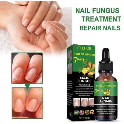 Nail Renewal Treatment Hand Foot And Nail Care Formula