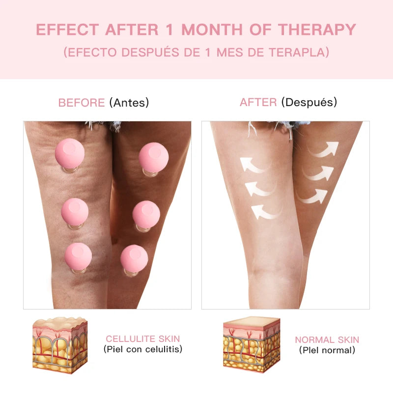 Silicone Vacuum Cupping Cup