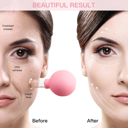 Silicone Vacuum Cupping Cup