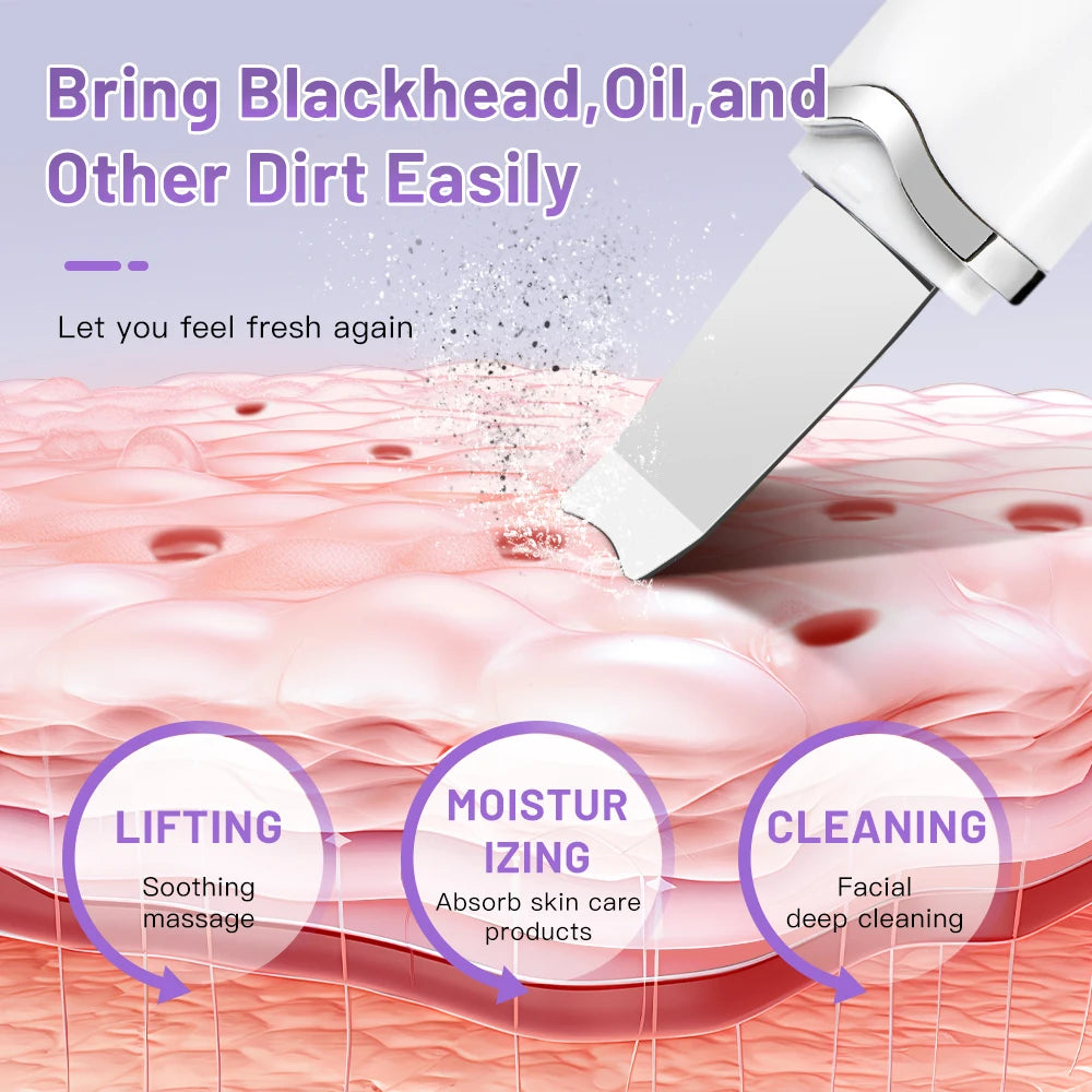 Ultrasonic Skin Scrubber Blackhead Remover