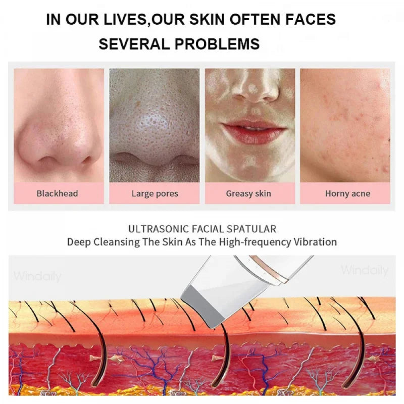 Ultrasonic Skin Care Spatula