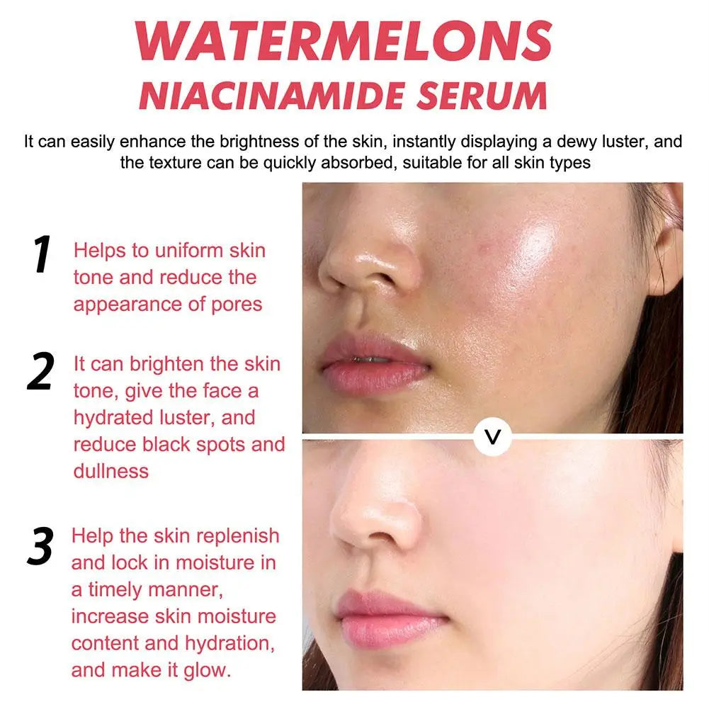 Watermelon Glow Niacinamide Dew Drops Serum