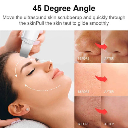 Ultrasonic Skin Care Spatula