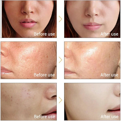 Woman Anti-wrinkle Whiten Ionic Face Massager Skin Care Facial Cleaner Beauty Electronic Iontophoresis