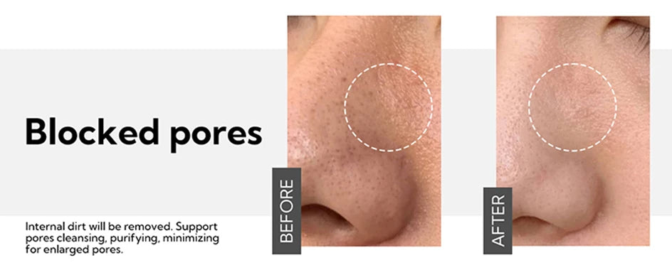 Pore Refining Serum