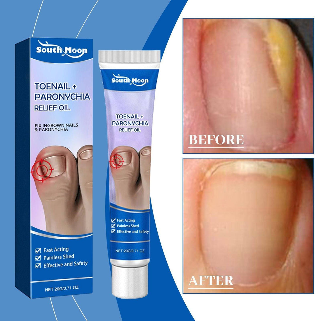 South Moon Nail Care Ointment, Moisturizing And Moisturizing For Nails