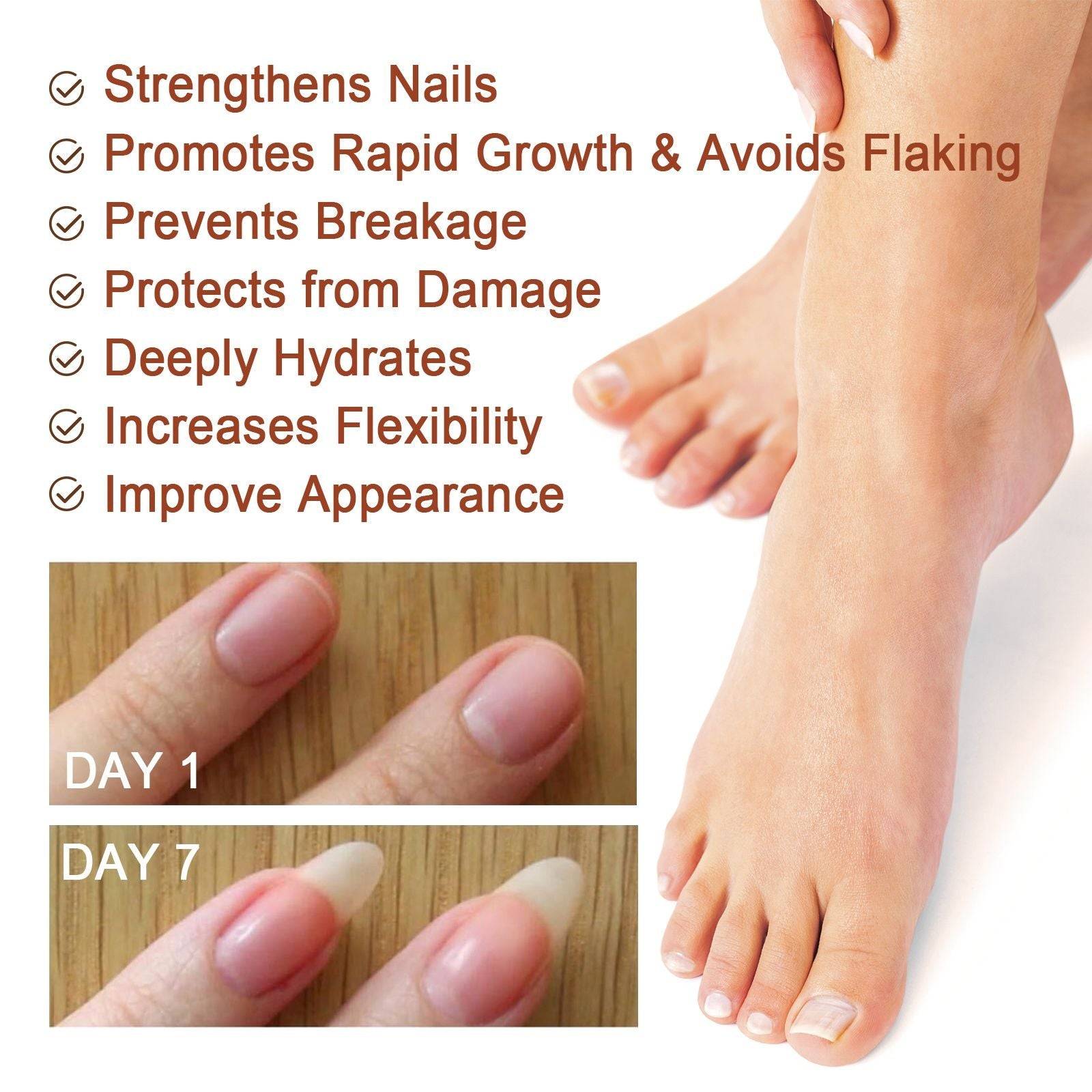 Jaysuing 7 Day Nail Care Essence Grey Nail, Hand, Foot And Nail