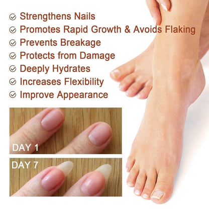 Jaysuing 7 Day Nail Care Essence Grey Nail, Hand, Foot And Nail